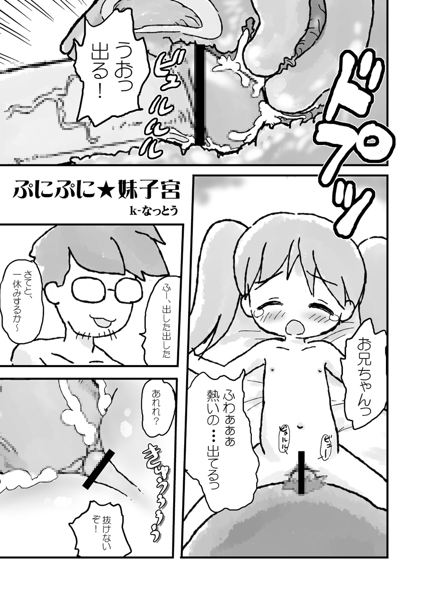 (だんめんずこみっく2) [Visual Biscuits (時浜次郎、ヨガ?、珍単JET)] 子宮戦線異状なし