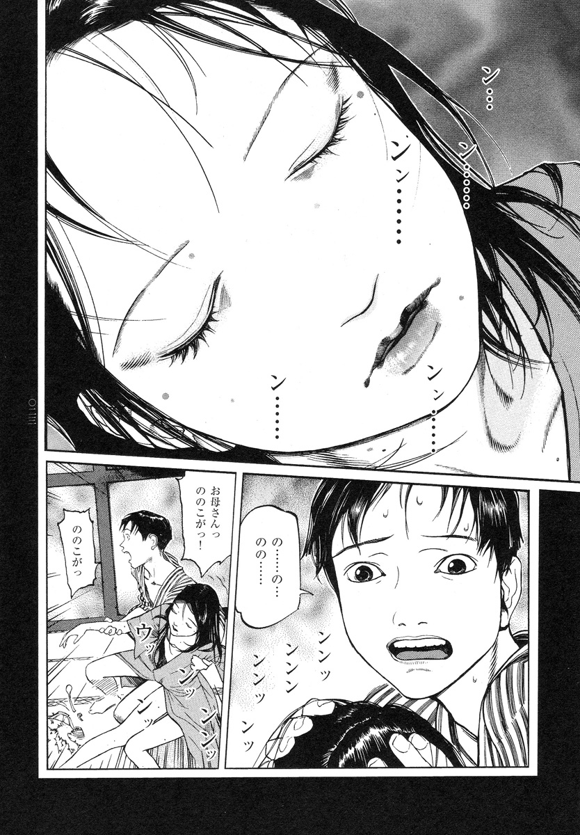【大越幸太郎】結合双生児