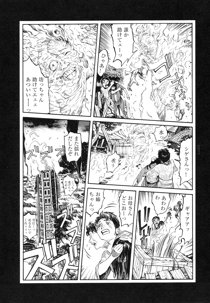 【大越幸太郎】結合双生児