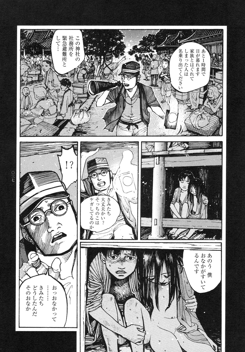 【大越幸太郎】結合双生児