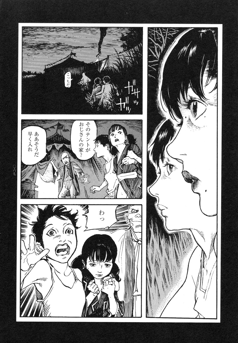 【大越幸太郎】結合双生児