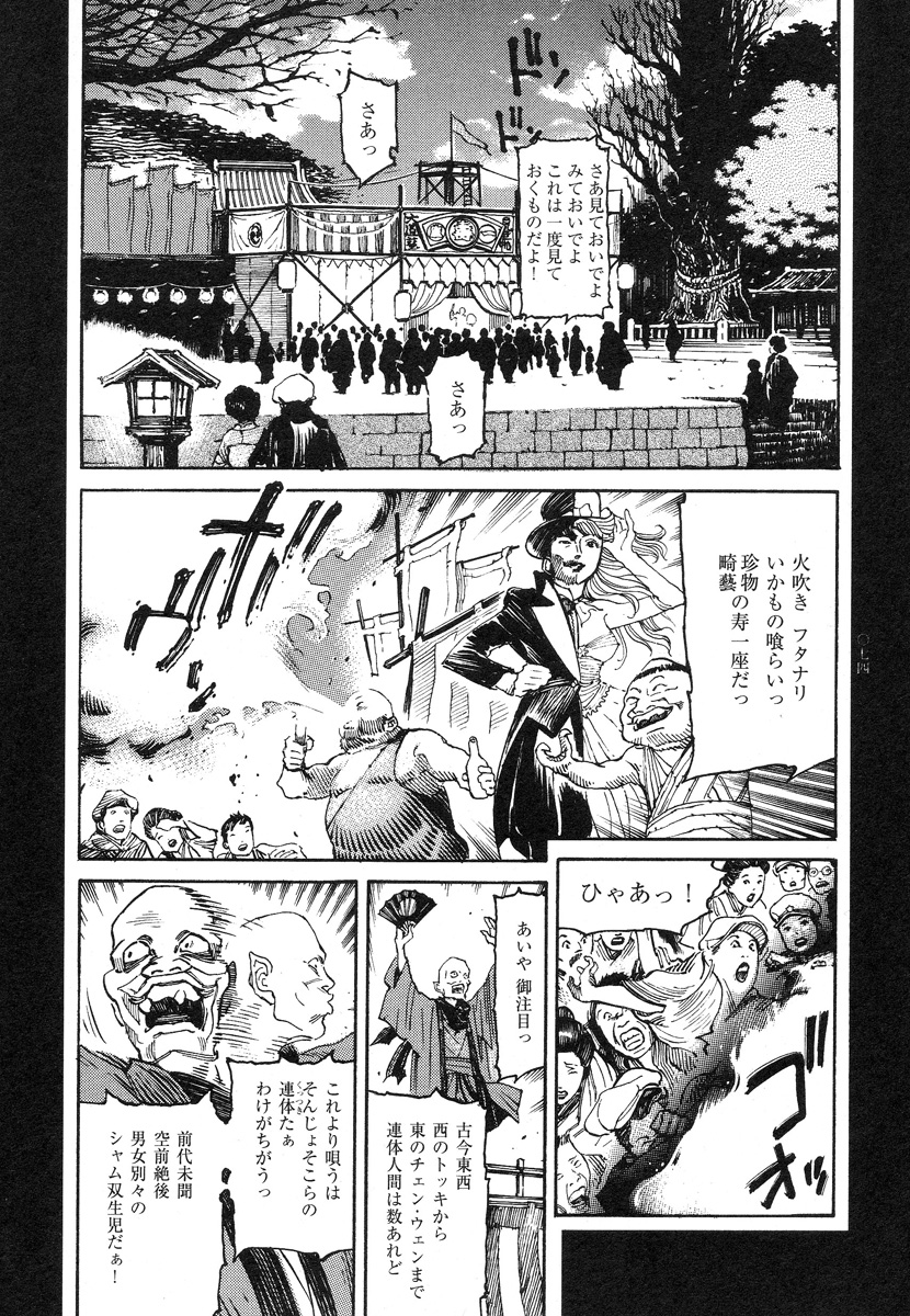 【大越幸太郎】結合双生児