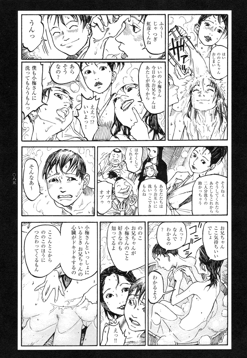 【大越幸太郎】結合双生児