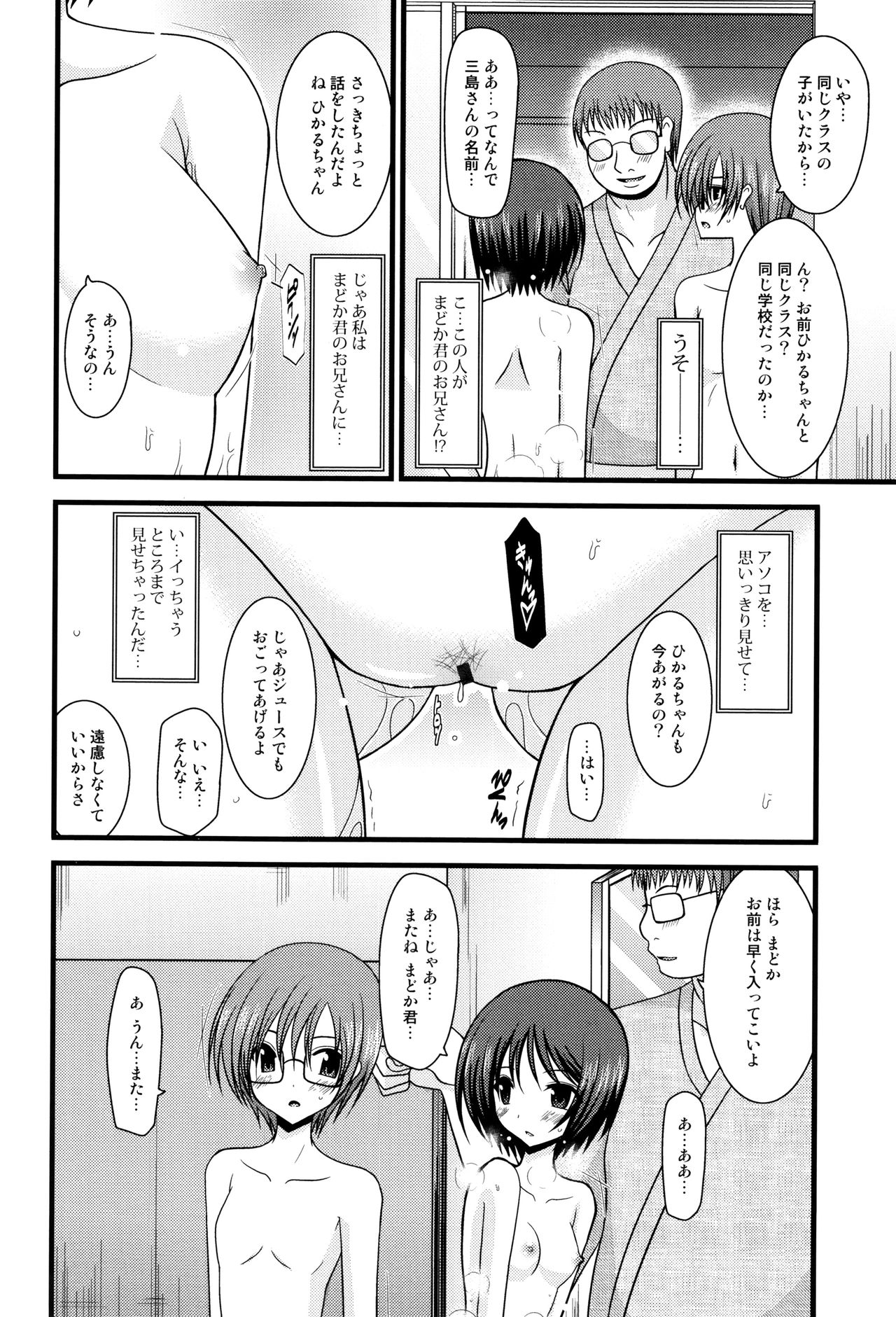 露出少女少女三島ひかるの聖火城