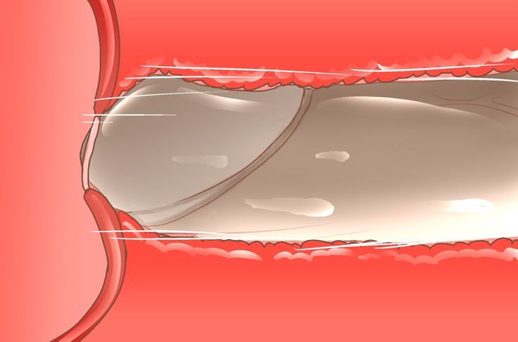NTR-カッコールドクラブ