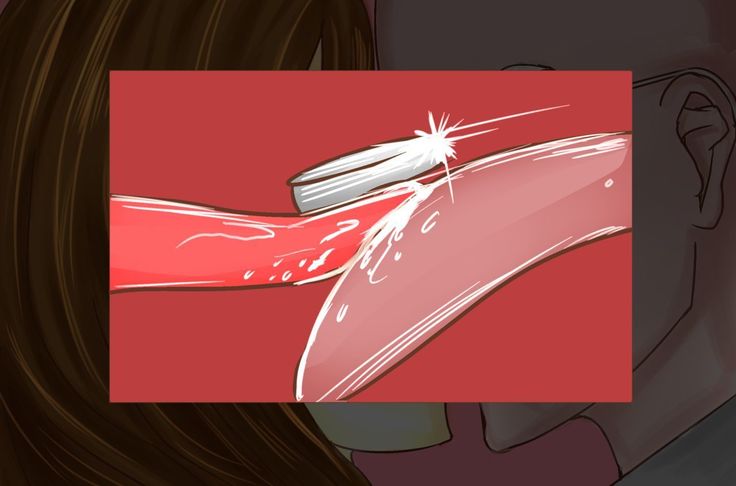 NTR-カッコールドクラブ